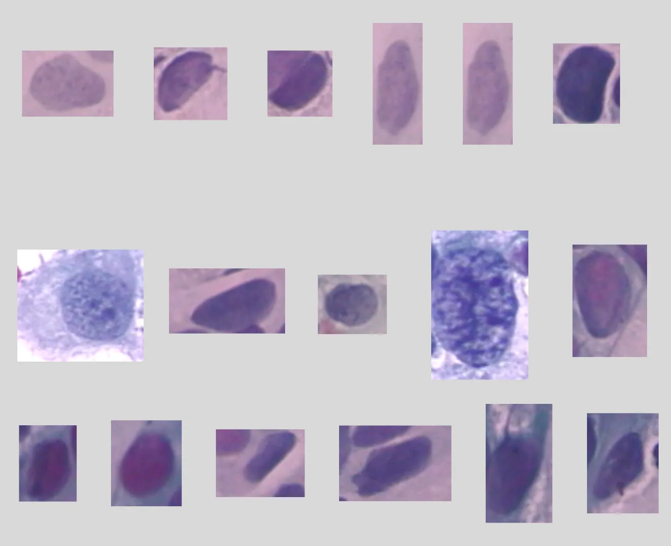 Imagen de células del dataset Smear2005